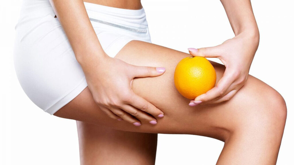 Cellulite-cause-e-rimedi-efficaci - KULT Beauty Room